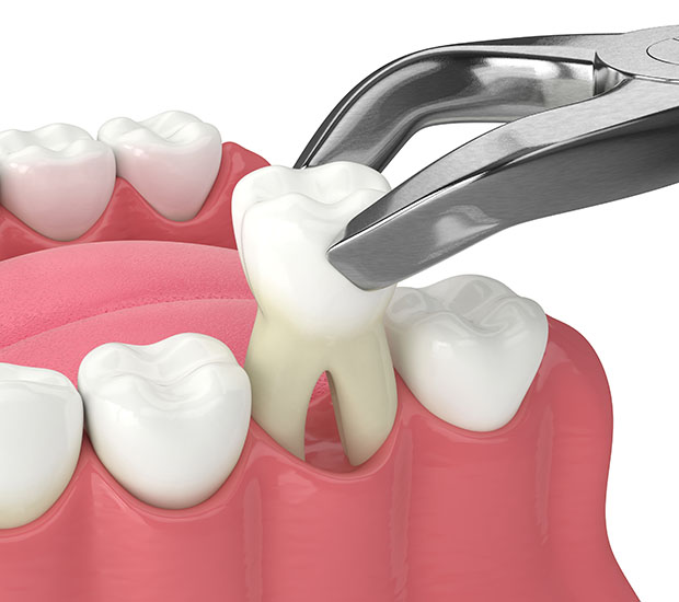 Boca Raton Periodontist