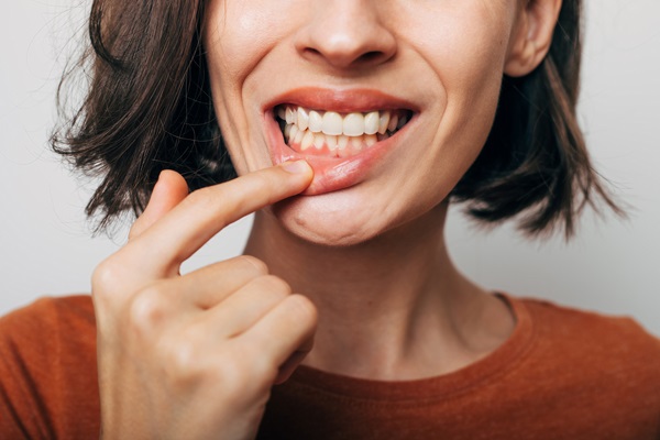 Understanding Gum Recession: Causes And Risk Factors