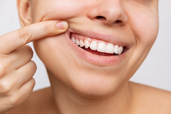 How A Periodontist Can Help With Receding Gums